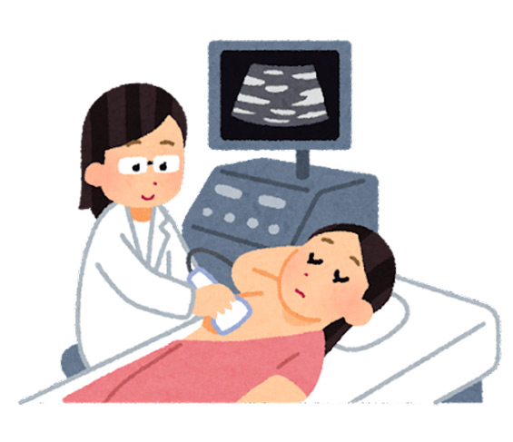 乳腺超音波検査